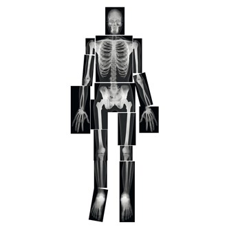 Röntgenbilder komplett människa